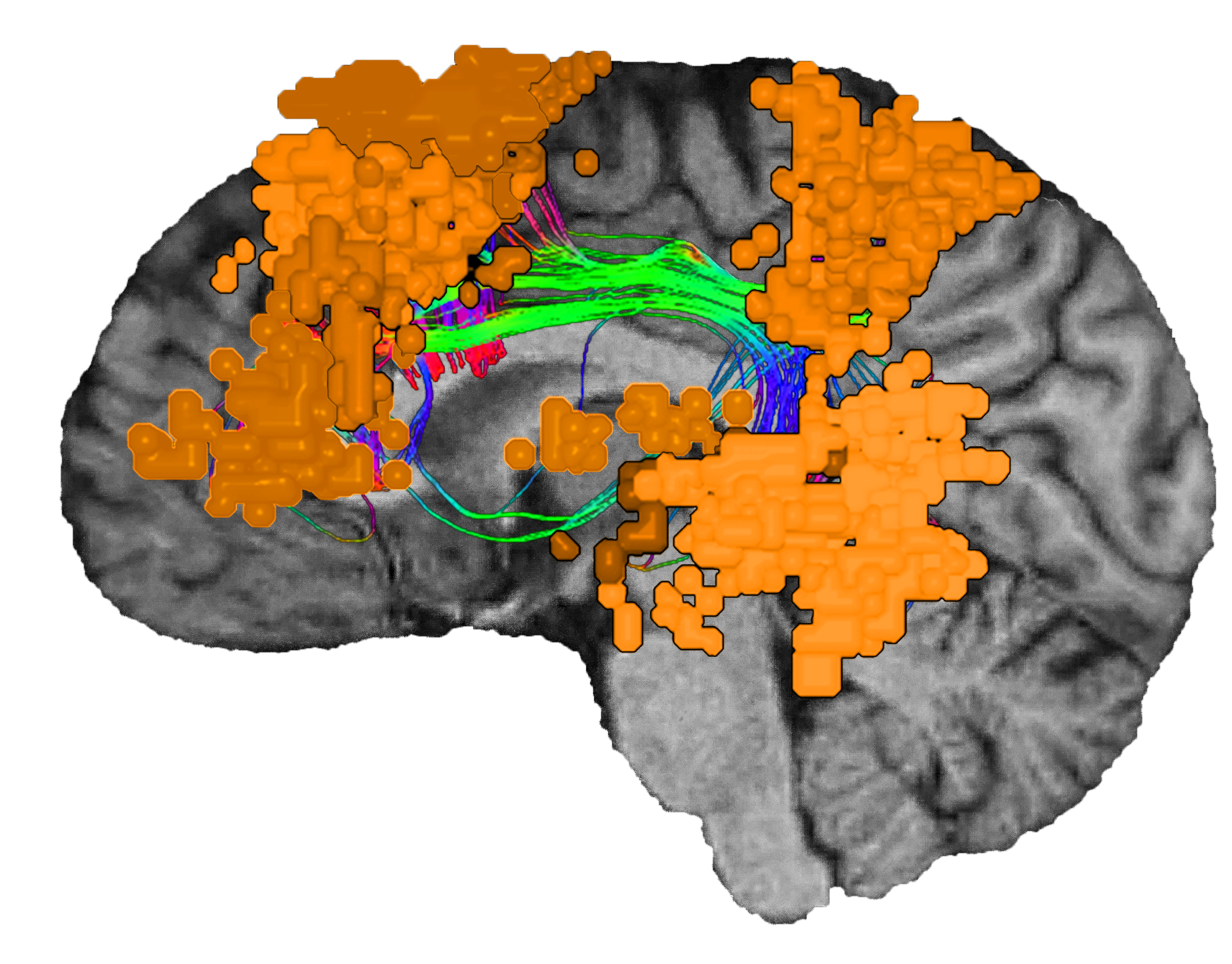 the-language-system