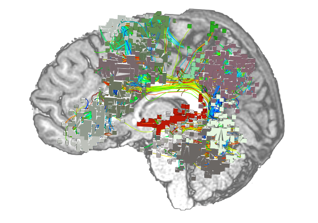 human brain mapping names