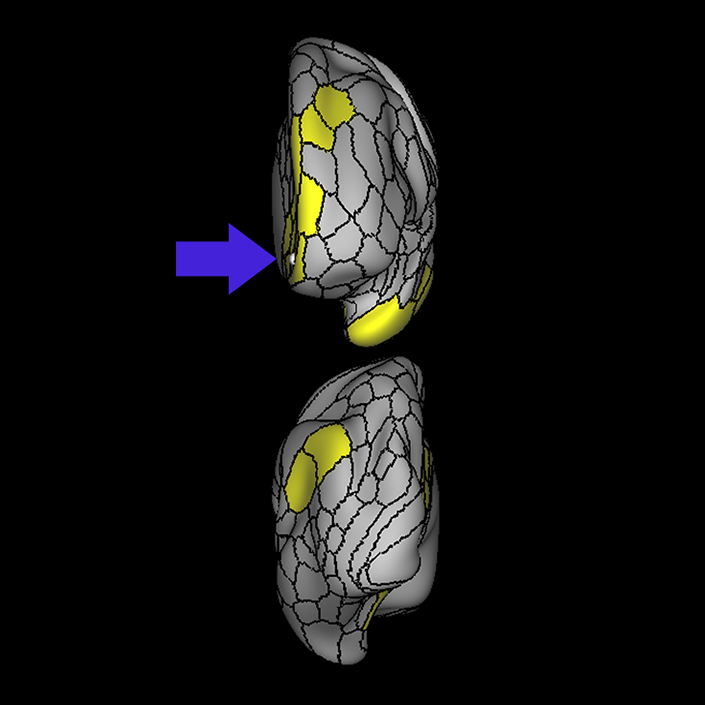 Default Mode Network - Connectome Guide