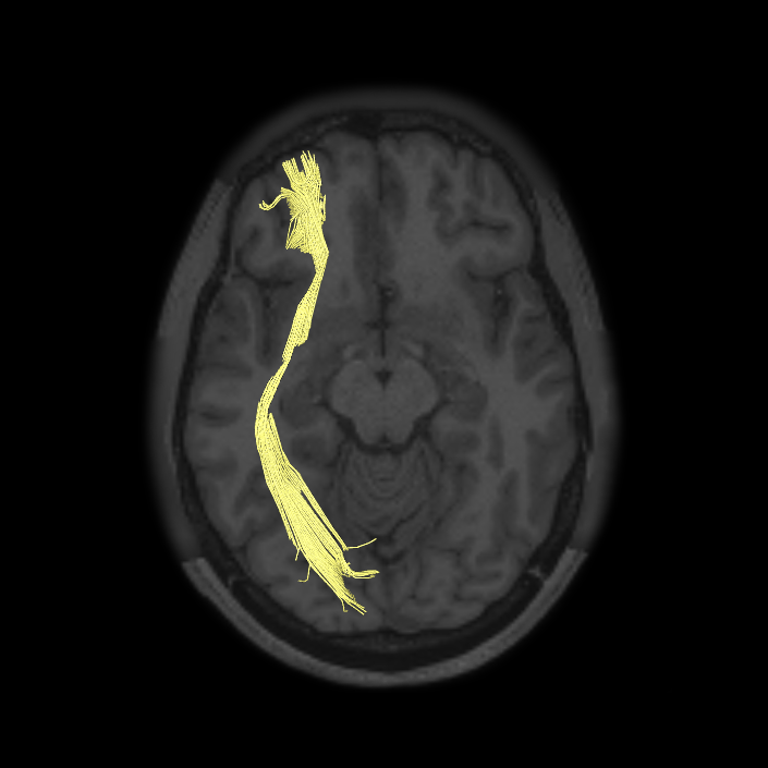 Limbic/Paralimbic System - Connectome Guide