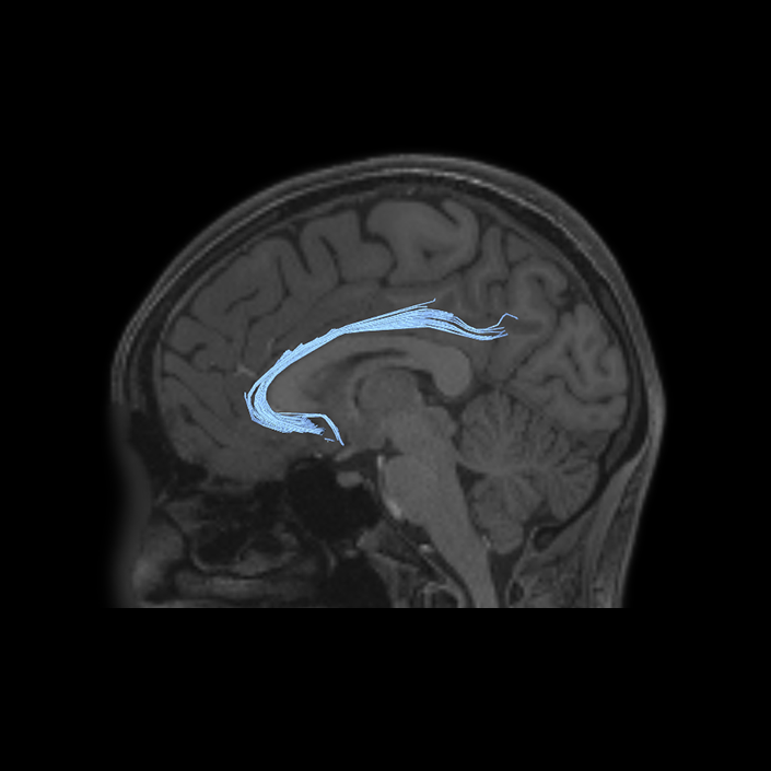 Limbic/Paralimbic System - Connectome Guide