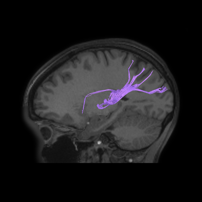 Auditory Network - Connectome Guide