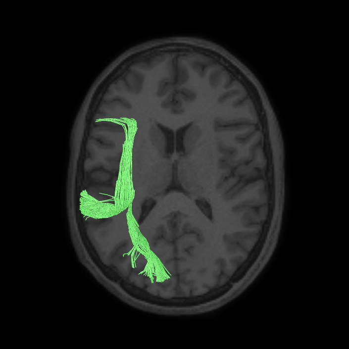 Auditory Network - Connectome Guide