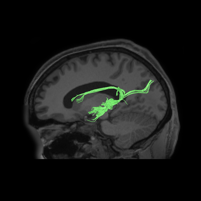 Auditory Network - Connectome Guide