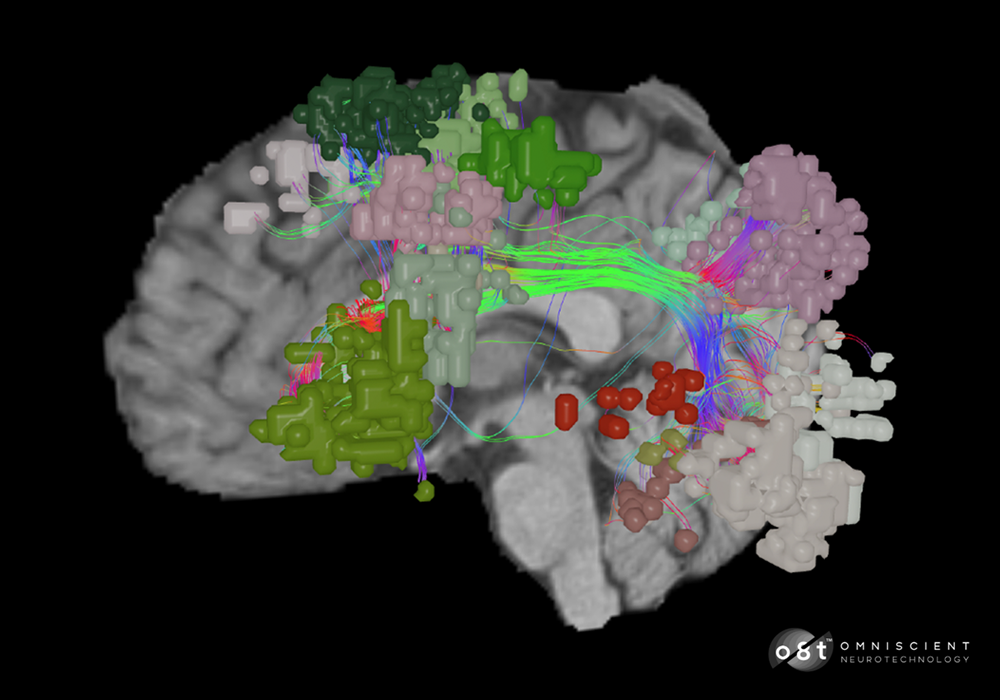 Important Brain Networks